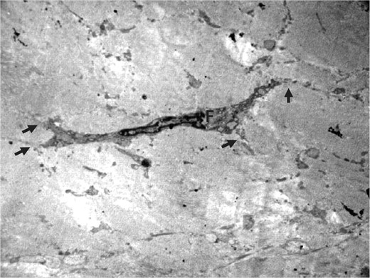 Şekil 1. Kültür ortamı enjekte edilen bölgede dördüncü ayda inaktif fibroblast (F) elektron mikrografı.