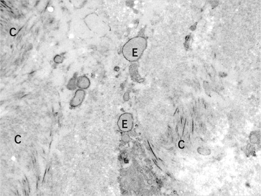 Şekil 2. Hyalüronik asit matrisi ve fibroblast karışımı enjekte edilen bölgede sekizinci ayda kollajen fibrillerinin arasında elastin materyali.