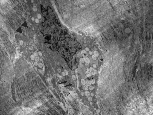Şekil 5. Hyalüronik asit matrisi ve fibroblast karışımı enjekte edilen bölgede sekizinci ayda genişlemiş, oval şekilli fibroblastın elektron mikrografı.